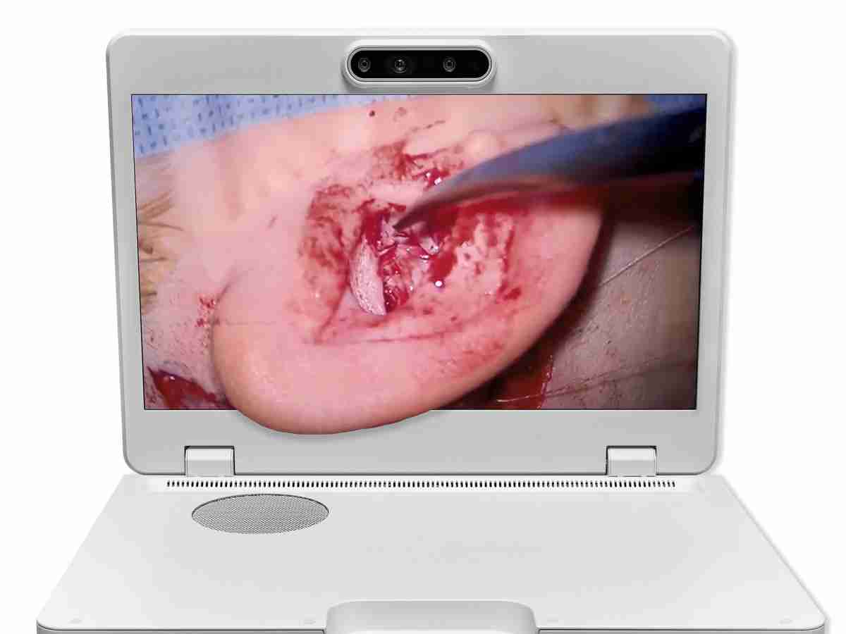 达擎之＂Heads-up 3D显微手术显示系统＂，，整合4K裸眼3D显示及眼球追踪系统，，具备快速追踪人眼移动位置功能，，，减轻医师长时间维持固定姿势的负担，，让医师能有更宽广清晰的3D立体视野及更舒适的姿势来执行手术。。。